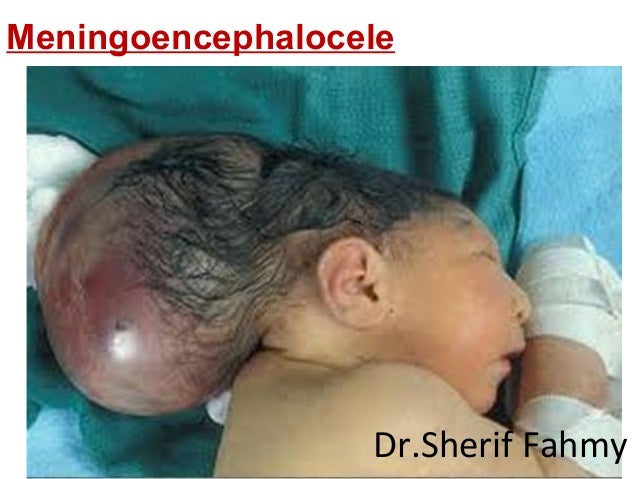 development-of-nervous-system-special-embryology-48-638.jpg
