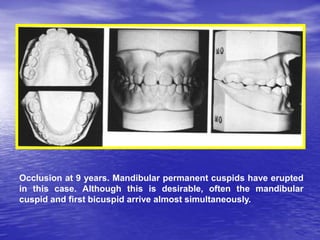 Development of normal dentition and occlusion | PPT