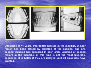 Development of normal dentition and occlusion | PPT
