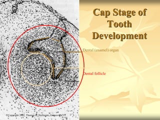 Cap Stage of
Tooth
Development
Dental (enamel) organ
Dental papilla
Dental follicle
©Copyright 2007, Thomas G. Hollinger, Gainesville, Fl
 
