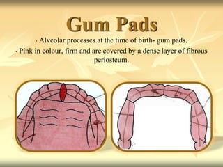 Gum Pads
• Alveolar processes at the time of birth- gum pads.
• Pink in colour, firm and are covered by a dense layer of fibrous
periosteum.
 