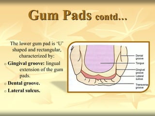 Gum Pads contd…
The lower gum pad is ‘U’
shaped and rectangular,
characterized by:
o Gingival groove: lingual
extension of the gum
pads.
o Dental groove.
o Lateral sulcus.
 