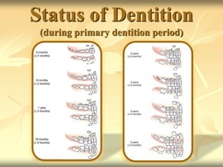 Status of Dentition
(during primary dentition period)
 