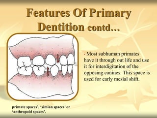 Features Of Primary
Dentition contd…
• Most subhuman primates
have it through out life and use
it for interdigitation of the
opposing canines. This space is
used for early mesial shift.
primate spaces’, ‘simian spaces’ or
‘anthropoid spaces’.
 