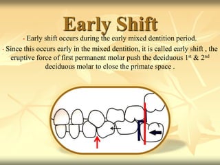 Early Shift
• Early shift occurs during the early mixed dentition period.
• Since this occurs early in the mixed dentition, it is called early shift , the
eruptive force of first permanent molar push the deciduous 1st & 2nd
deciduous molar to close the primate space .
 