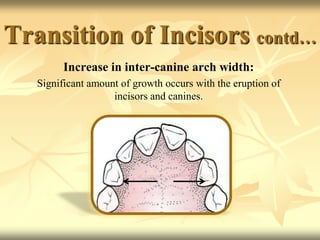 Transition of Incisors contd…
Increase in inter-canine arch width:
Significant amount of growth occurs with the eruption of
incisors and canines.
 