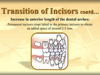Transition of Incisors contd…
Increase in anterior length of the dental arches:
Permanent incisors erupt labial to the primary incisors to obtain
an added space of around 2-3 mm.
 
