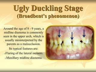 Ugly Duckling Stage
(Broadbent’s phenomenon)
Around the age of 8 - 9 years, a
midline diastema is commonly
seen in the upper arch, which is
usually misinterpreted by the
parents as a malocclusion.
Its typical features are:
oFlaring of the lateral incisors.
oMaxillary midline diastema.
 
