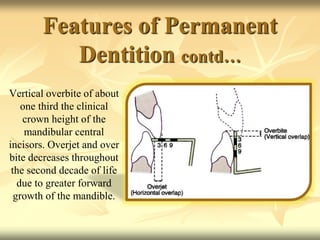 Features of Permanent
Dentition contd…
Vertical overbite of about
one third the clinical
crown height of the
mandibular central
incisors. Overjet and over
bite decreases throughout
the second decade of life
due to greater forward
growth of the mandible.
 