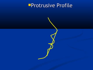 Proclusive Development of occlusion | PPT