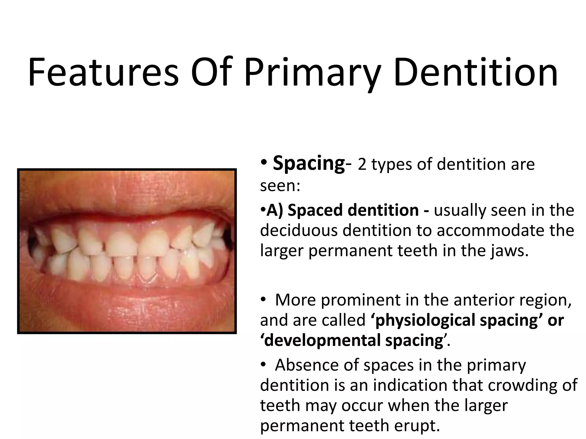 Features Of Primary Dentition
• Spacing- 2 types of dentition are
seen:
•A) Spaced dentition - usually seen in the
deciduous dentition to accommodate the
larger permanent teeth in the jaws.
• More prominent in the anterior region,
and are called ‘physiological spacing’ or
‘developmental spacing’.
• Absence of spaces in the primary
dentition is an indication that crowding of
teeth may occur when the larger
permanent teeth erupt.
 