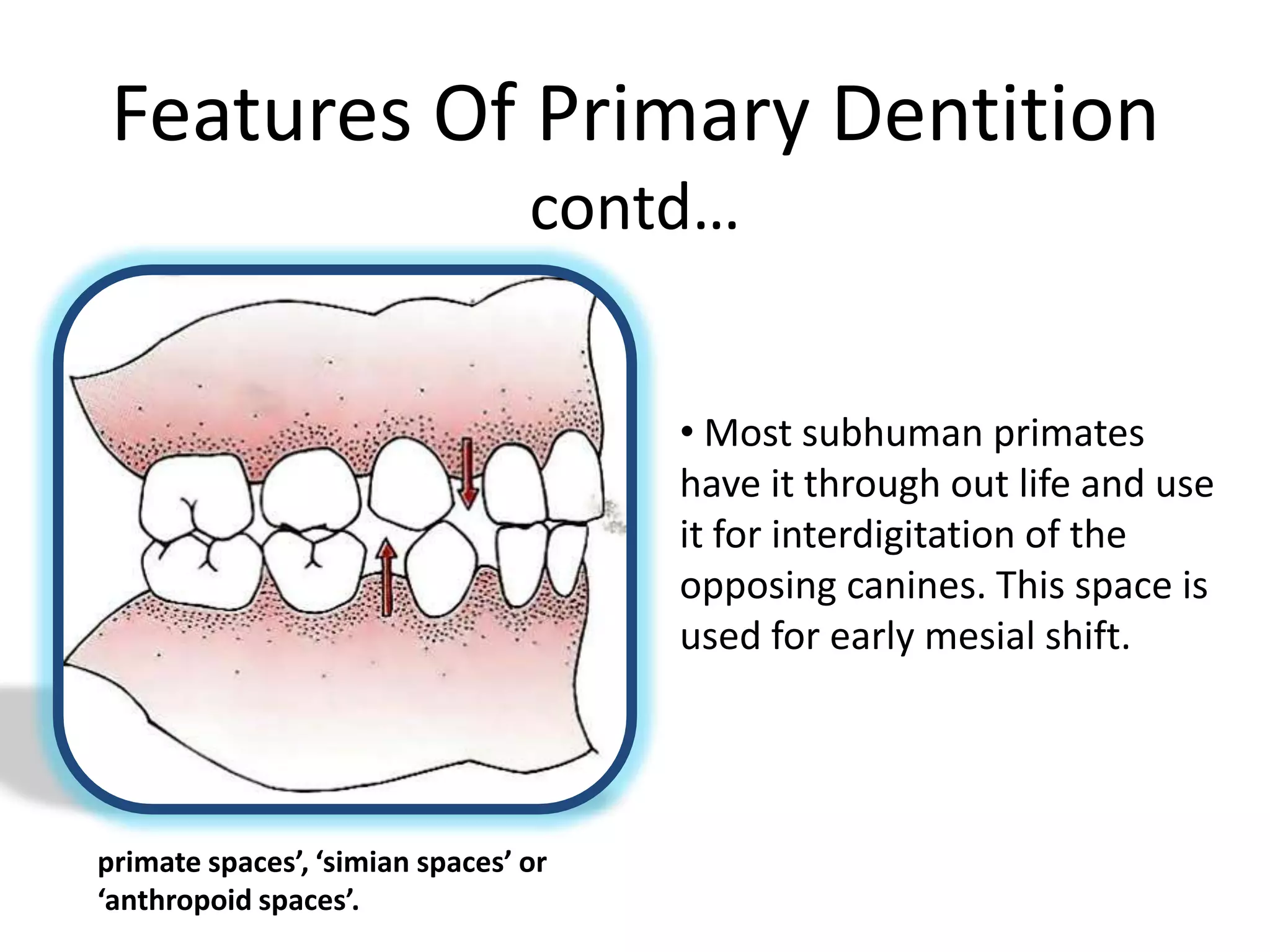 Features Of Primary Dentition
contd…
• Most subhuman primates
have it through out life and use
it for interdigitation of the
opposing canines. This space is
used for early mesial shift.
primate spaces’, ‘simian spaces’ or
‘anthropoid spaces’.
 