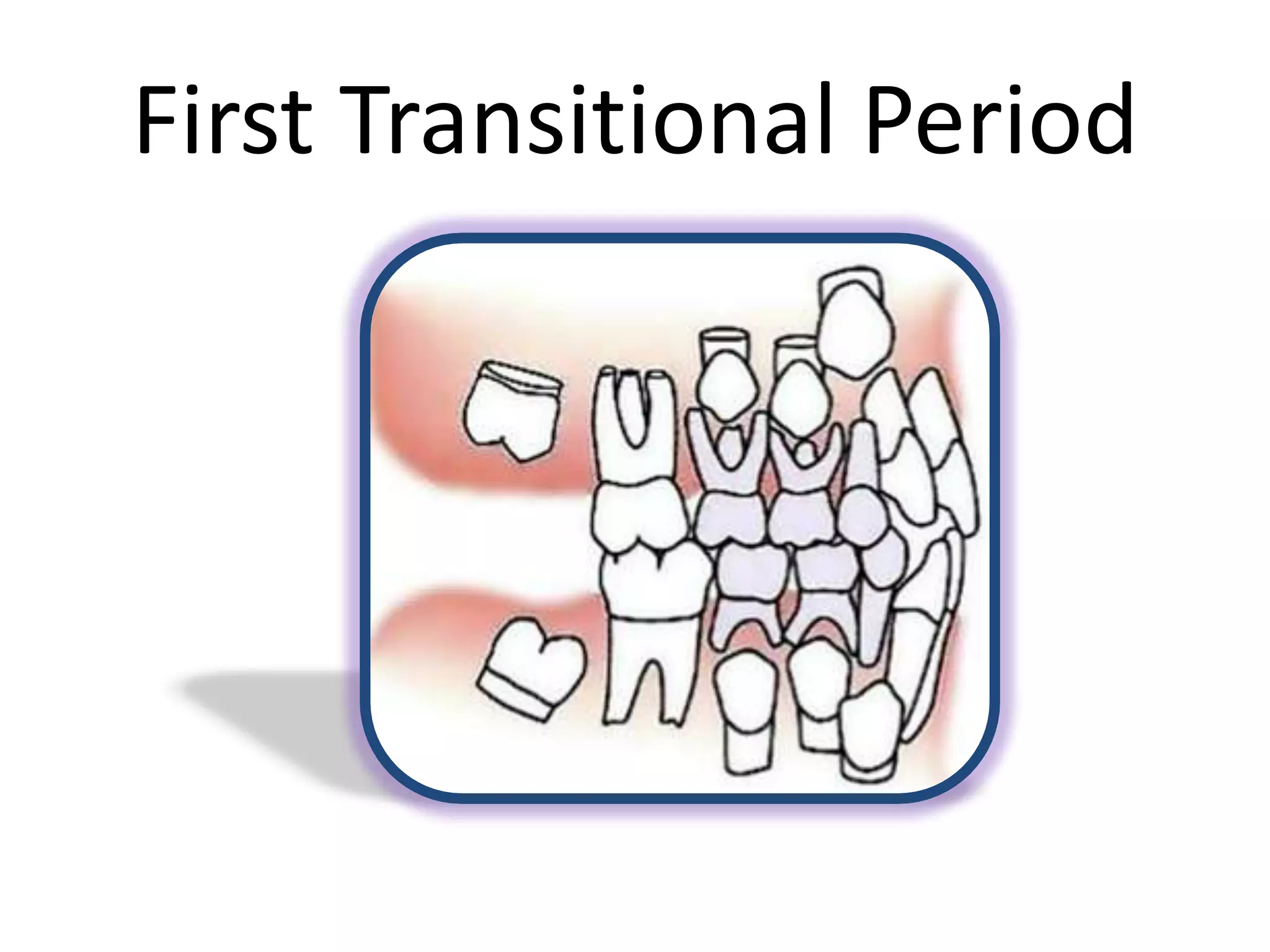 First Transitional Period
 