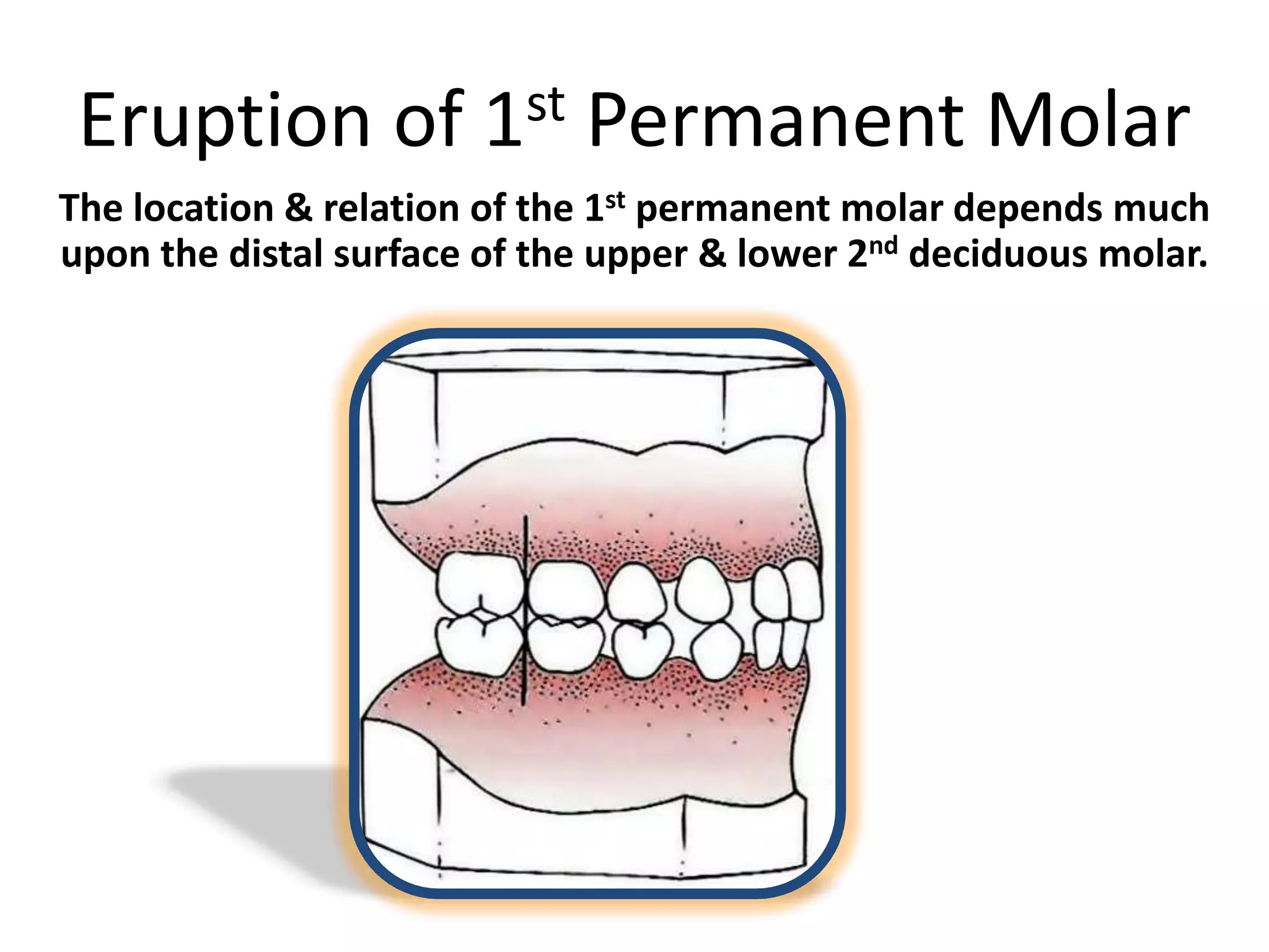 Eruption of 1st Permanent Molar
The location & relation of the 1st permanent molar depends much
upon the distal surface of the upper & lower 2nd deciduous molar.
 