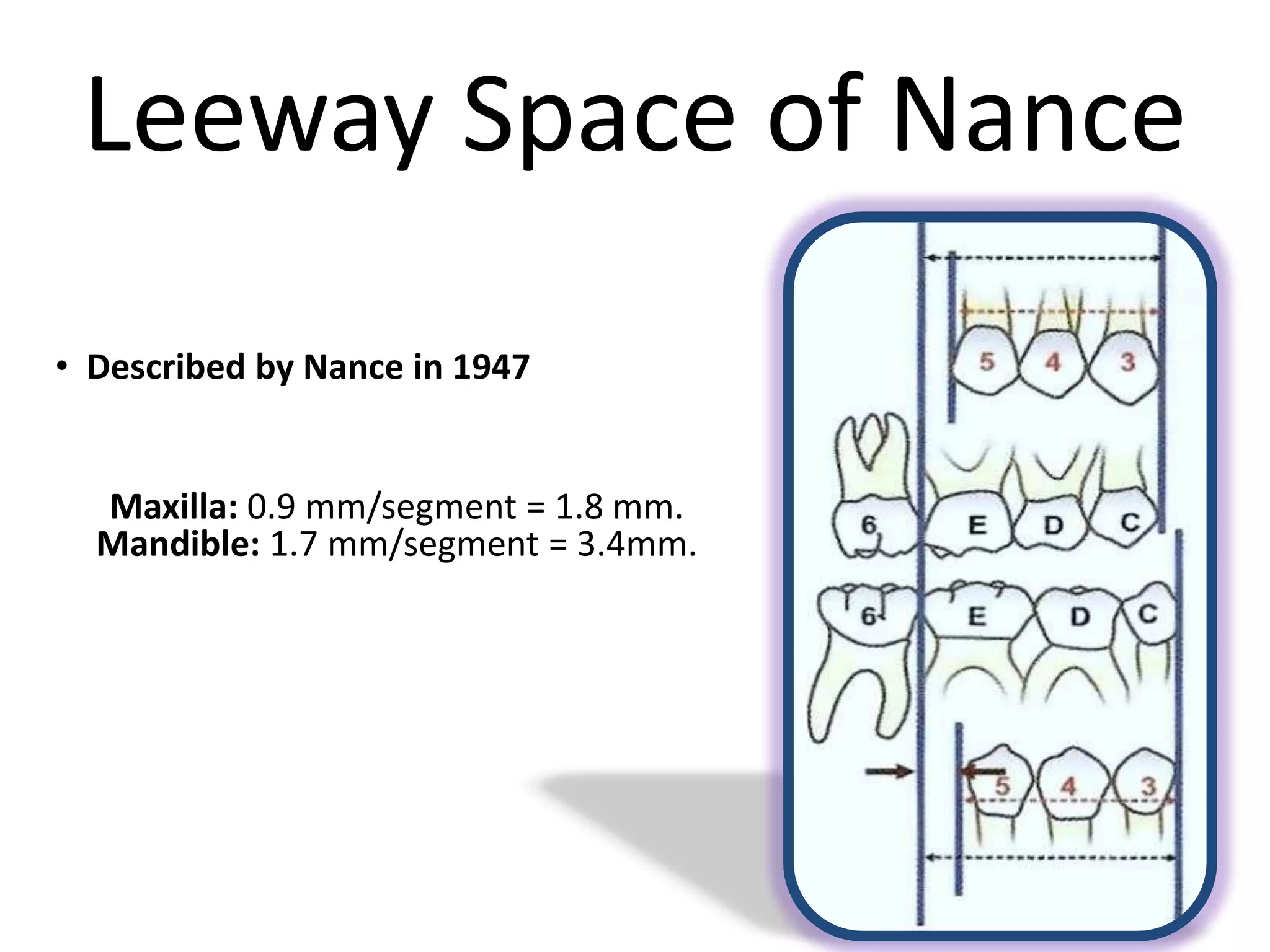 Leeway Space of Nance
• Described by Nance in 1947
Maxilla: 0.9 mm/segment = 1.8 mm.
Mandible: 1.7 mm/segment = 3.4mm.
 