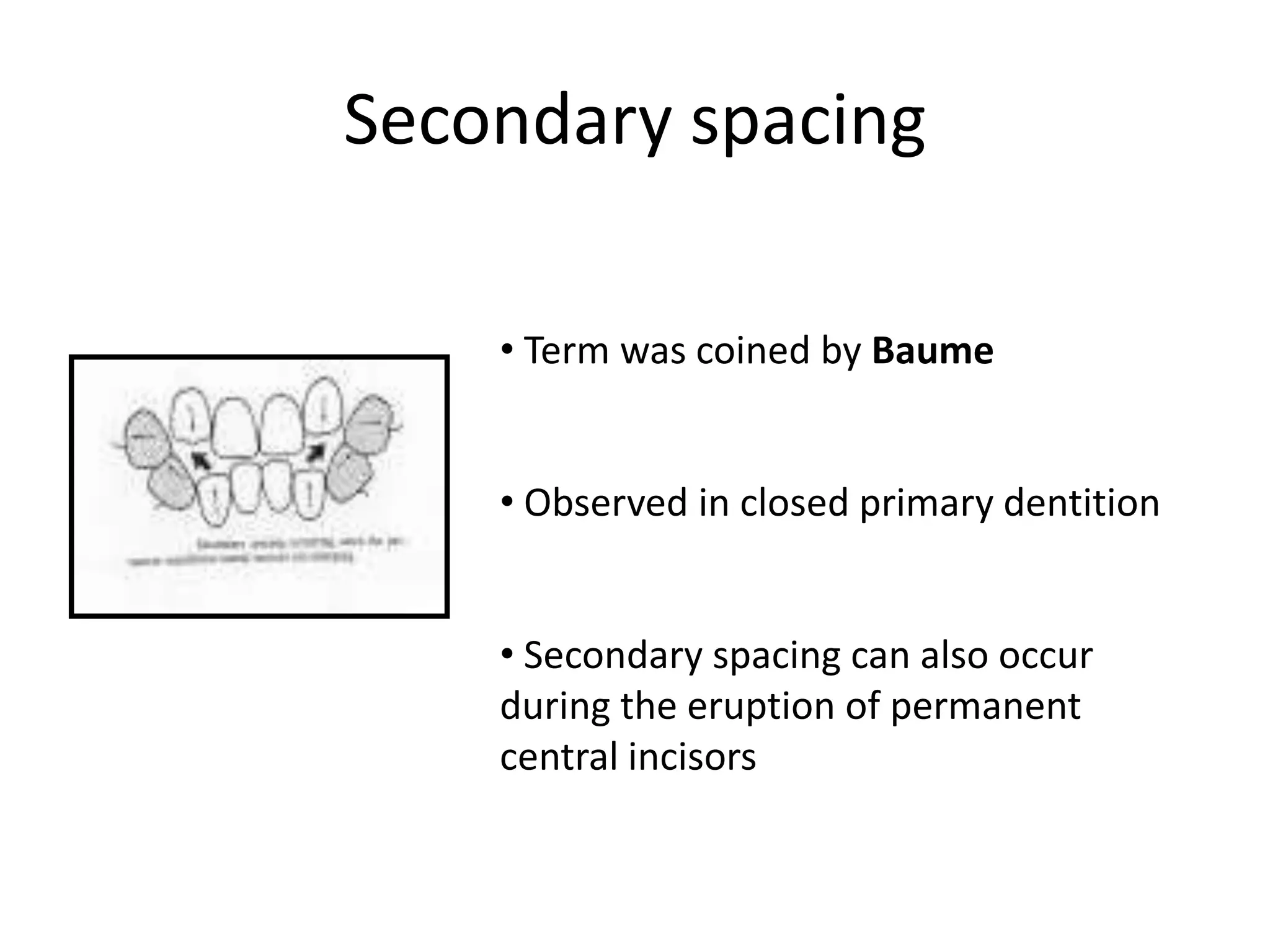 Secondary spacing
• Term was coined by Baume
• Observed in closed primary dentition
• Secondary spacing can also occur
during the eruption of permanent
central incisors
 