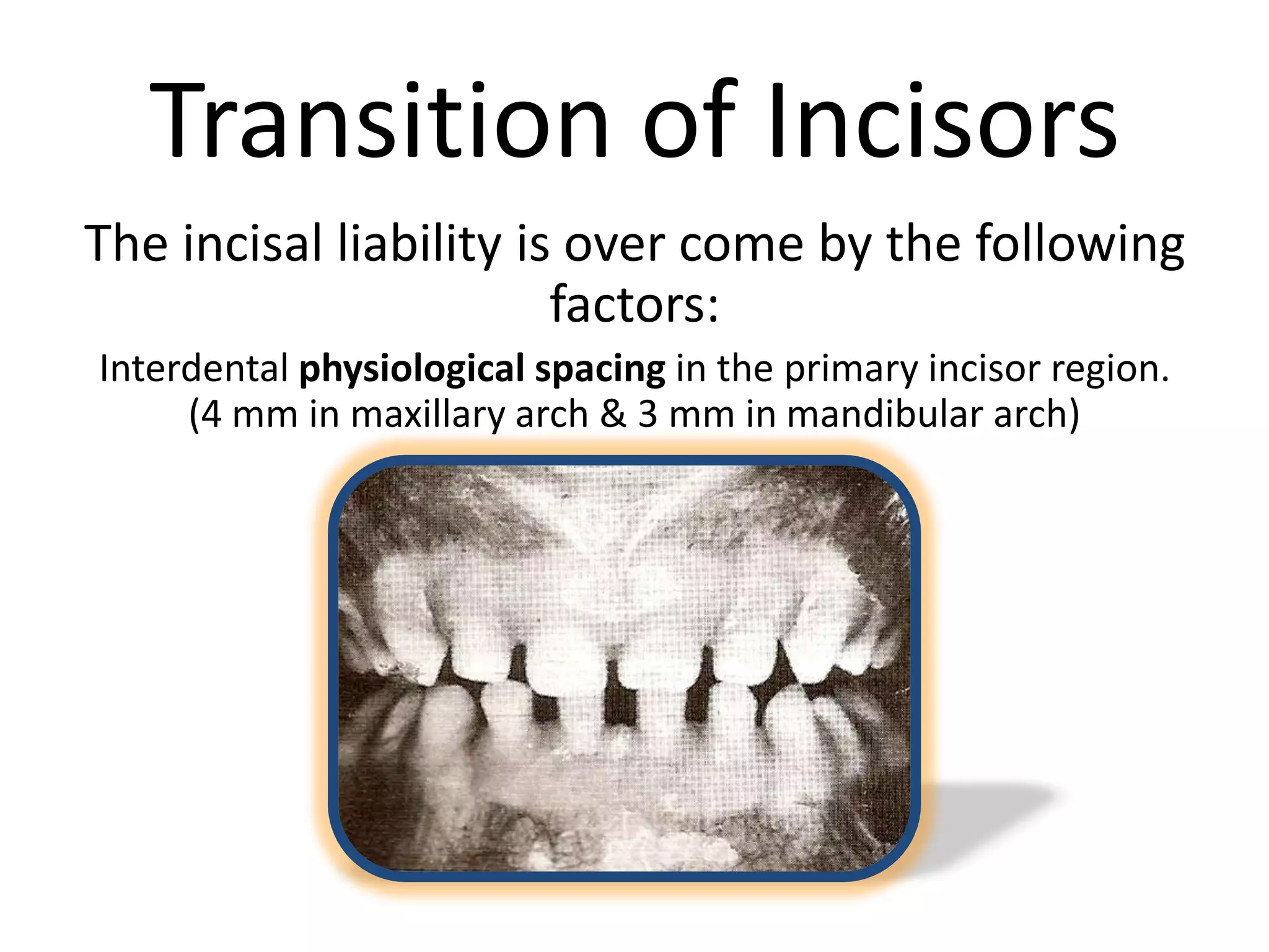 Transition of Incisors
The incisal liability is over come by the following
factors:
Interdental physiological spacing in the primary incisor region.
(4 mm in maxillary arch & 3 mm in mandibular arch)
 