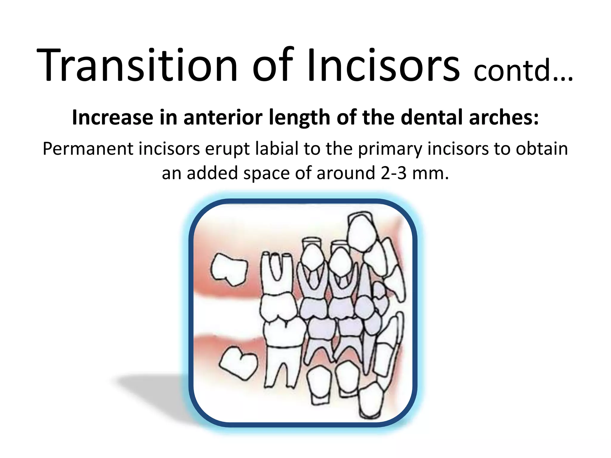 Transition of Incisors contd…
Increase in anterior length of the dental arches:
Permanent incisors erupt labial to the primary incisors to obtain
an added space of around 2-3 mm.
 