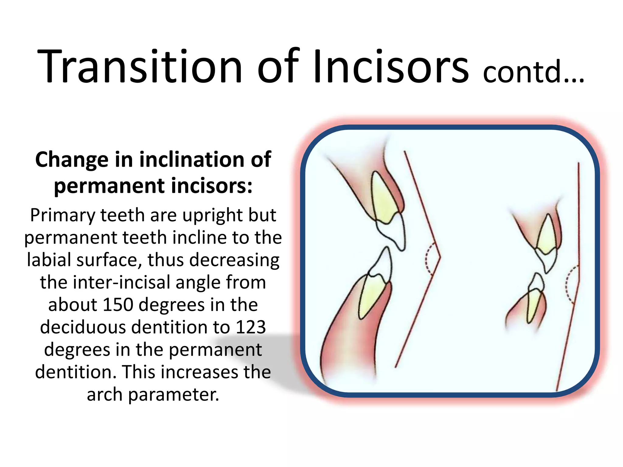 Transition of Incisors contd…
Change in inclination of
permanent incisors:
Primary teeth are upright but
permanent teeth incline to the
labial surface, thus decreasing
the inter-incisal angle from
about 150 degrees in the
deciduous dentition to 123
degrees in the permanent
dentition. This increases the
arch parameter.
 