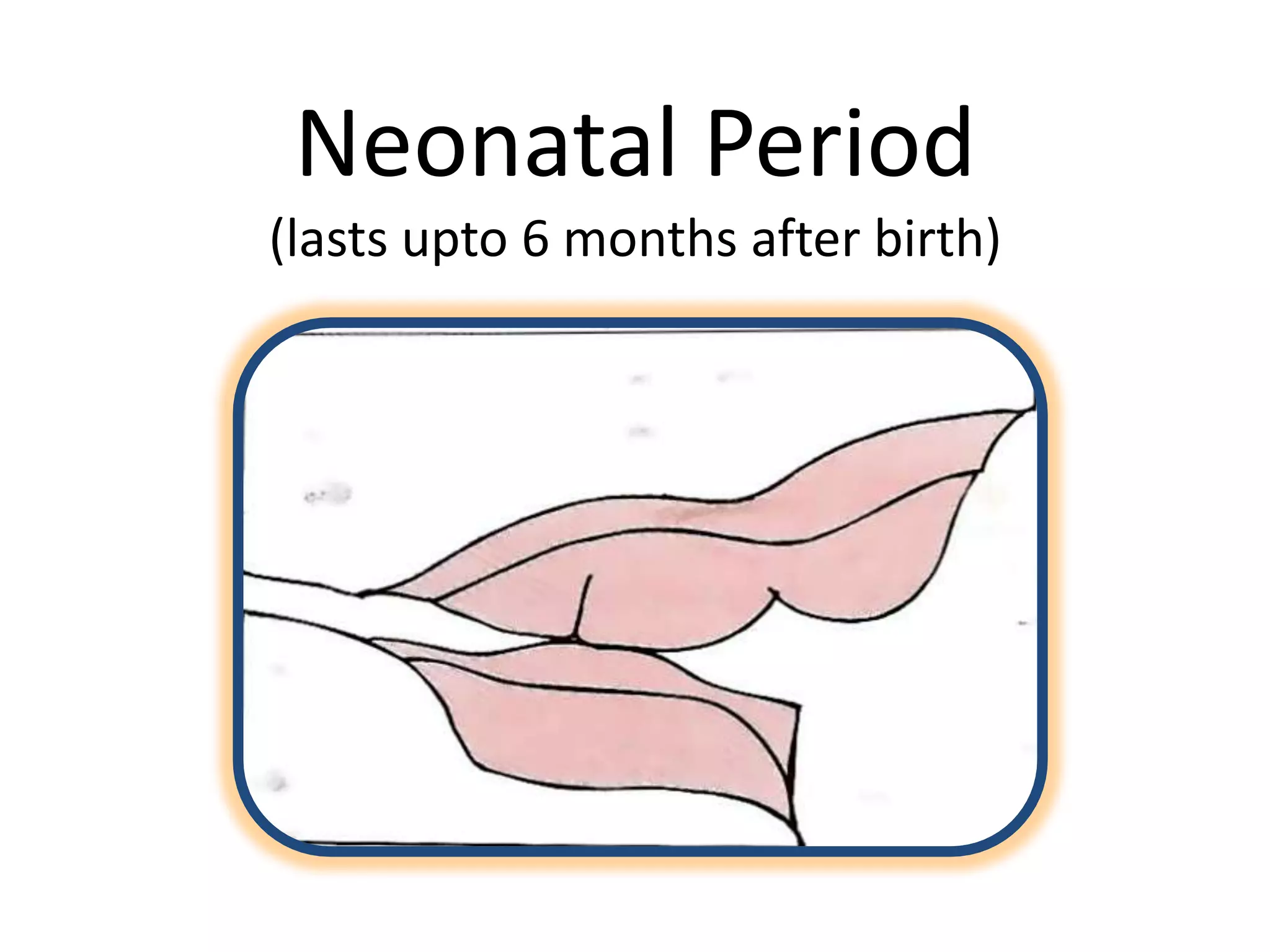 Neonatal Period
(lasts upto 6 months after birth)
 