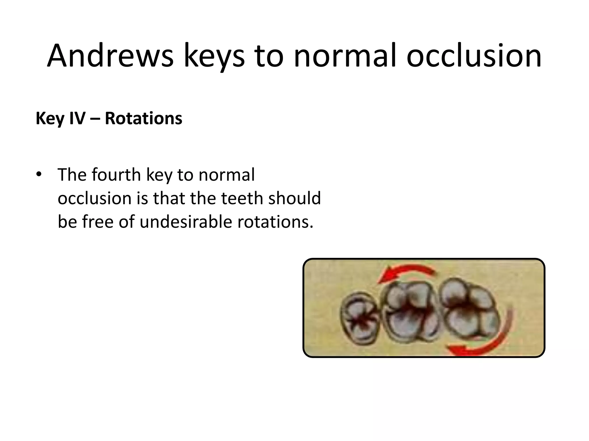 Andrews keys to normal occlusion
Key IV – Rotations
• The fourth key to normal
occlusion is that the teeth should
be free of undesirable rotations.
 