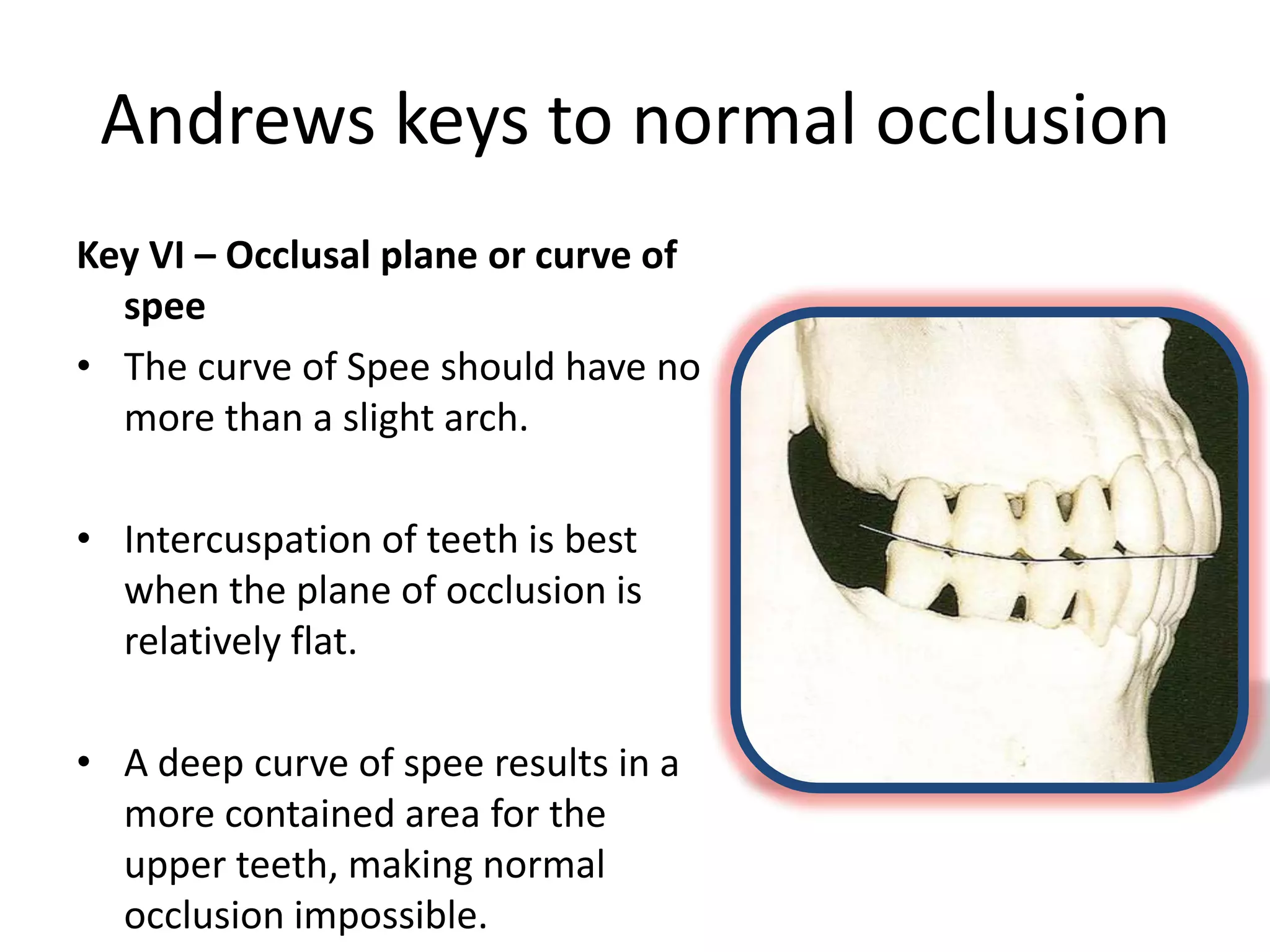 Andrews keys to normal occlusion
Key VI – Occlusal plane or curve of
spee
• The curve of Spee should have no
more than a slight arch.
• Intercuspation of teeth is best
when the plane of occlusion is
relatively flat.
• A deep curve of spee results in a
more contained area for the
upper teeth, making normal
occlusion impossible.
 