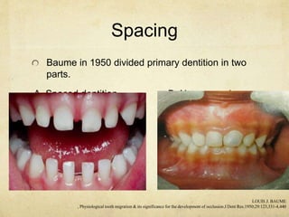 Development of occlusion | PPTX