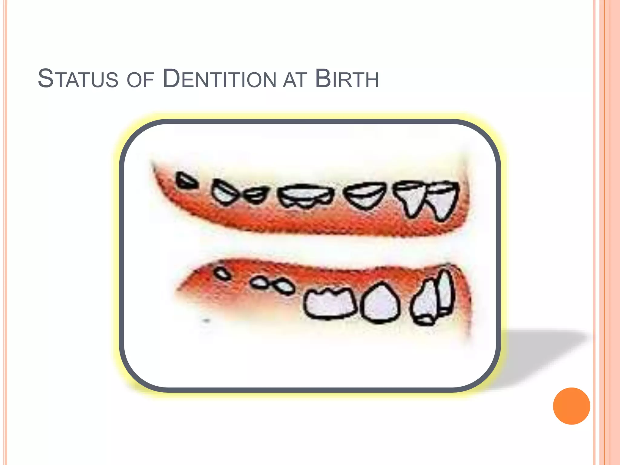 STATUS OF DENTITION AT BIRTH
 