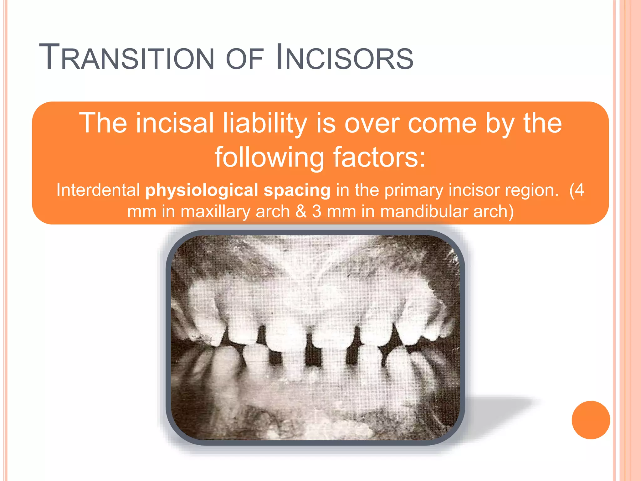 TRANSITION OF INCISORS
The incisal liability is over come by the
following factors:
Interdental physiological spacing in the primary incisor region. (4
mm in maxillary arch & 3 mm in mandibular arch)
 