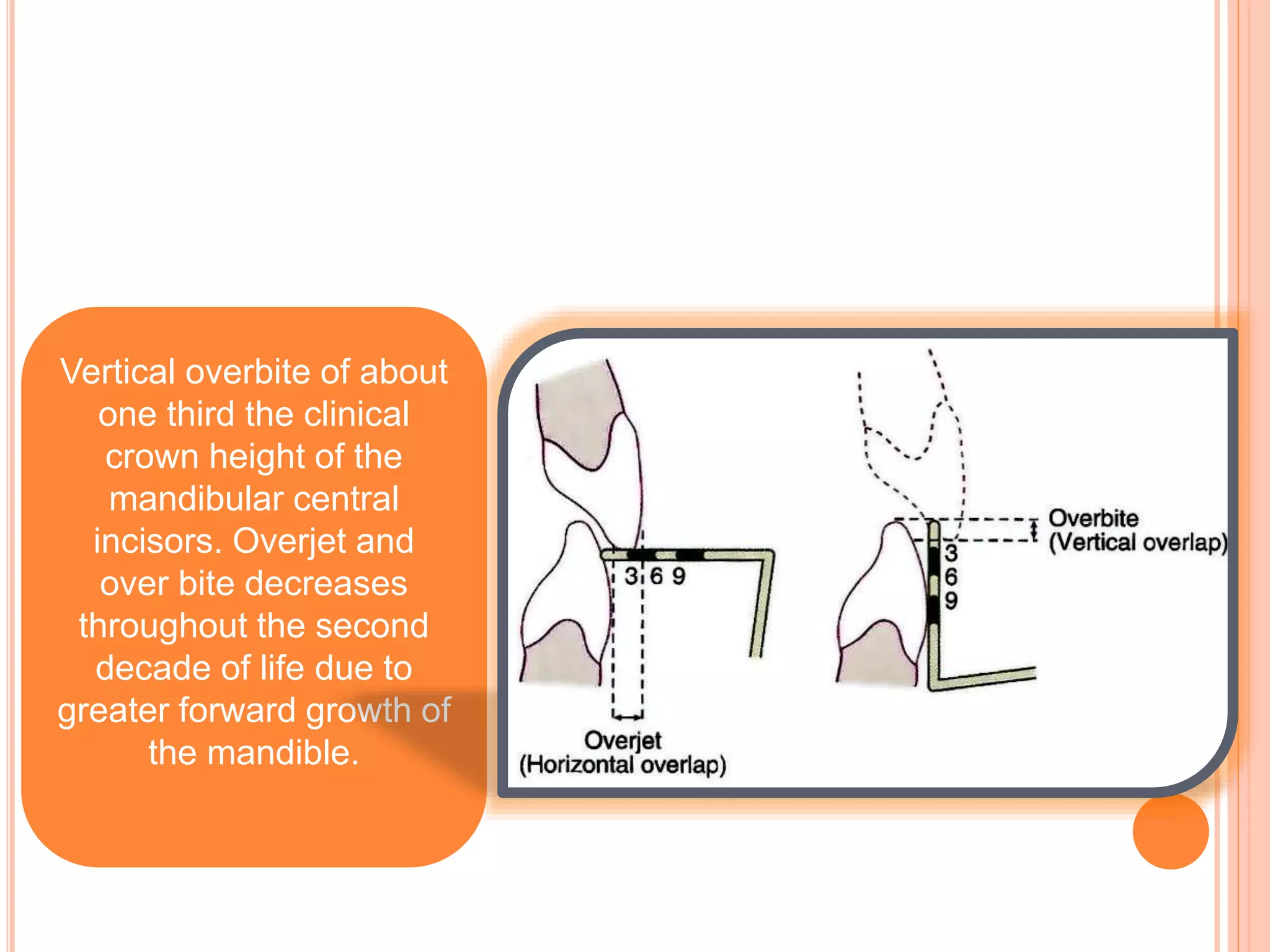 Vertical overbite of about
one third the clinical
crown height of the
mandibular central
incisors. Overjet and
over bite decreases
throughout the second
decade of life due to
greater forward growth of
the mandible.
 