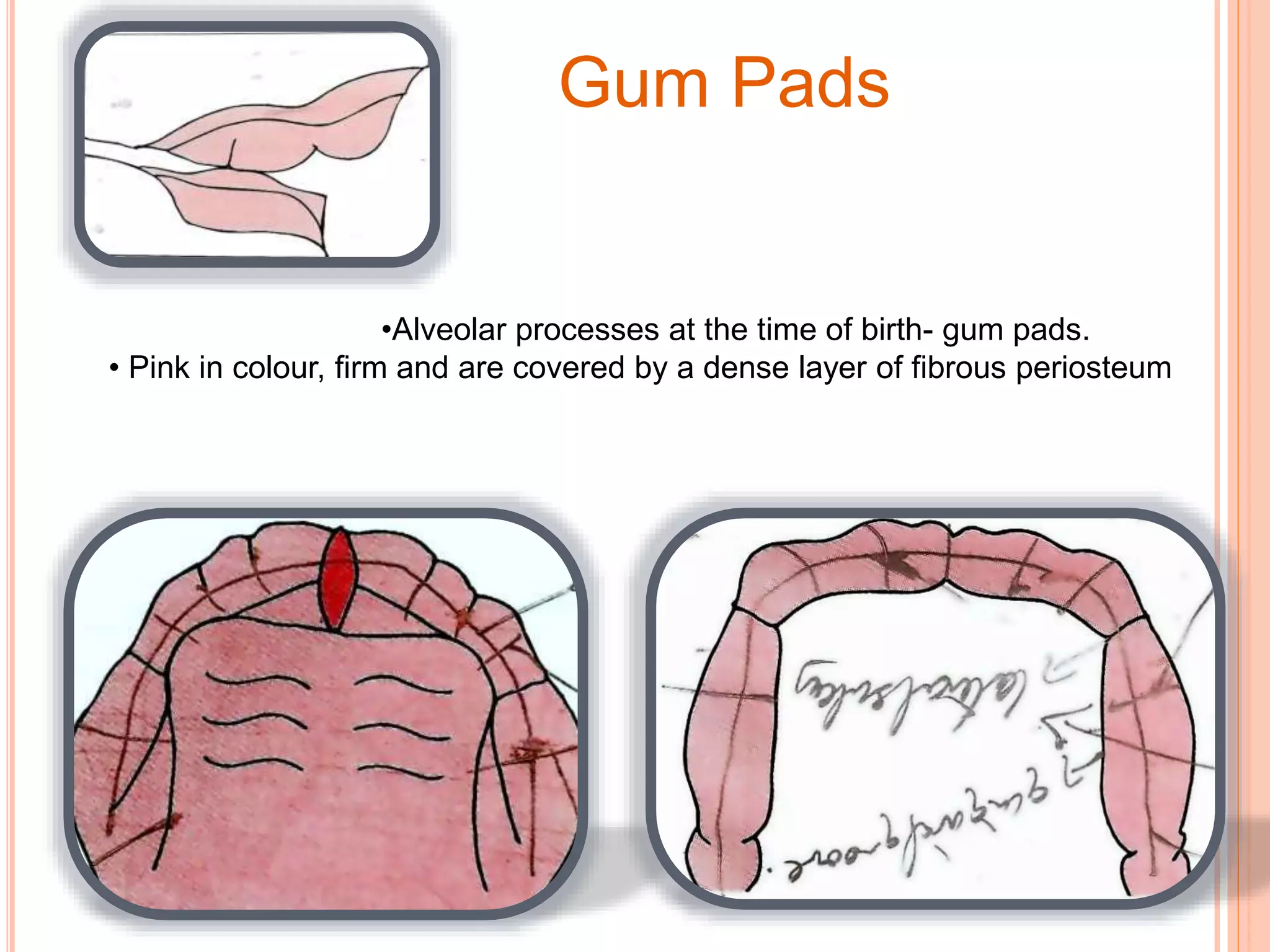 GUM PADS
•Alveolar processes at the time of birth- gum pads.
• Pink in colour, firm and are covered by a dense layer of fibrous periosteum
Gum Pads
 