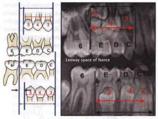 Leeway space of Nance
 