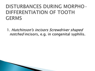 1. Hutchinson's incisors Screwdriver shaped
notched incisors, e.g. in congenital syphilis.
 