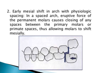 2. Early mesial shift in arch with physiologic
spacing: In a spaced arch, eruptive force of
the permanent molars causes closing of any
spaces between the primary molars or
primate spaces, thus allowing molars to shift
mesially.
 