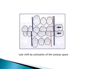 Late shift by utilization of the Leeway space
 