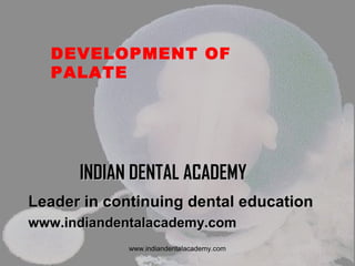 DEVELOPMENT OF
PALATE

INDIAN DENTAL ACADEMY
Leader in continuing dental education
www.indiandentalacademy.com
www.indiandentalacademy.com

 