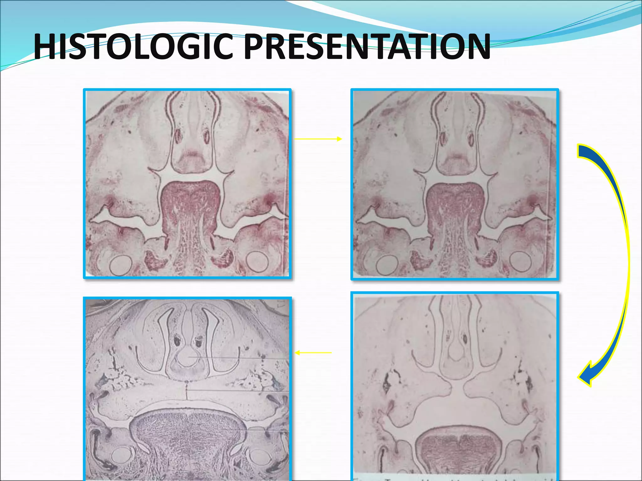 HISTOLOGIC PRESENTATION
 