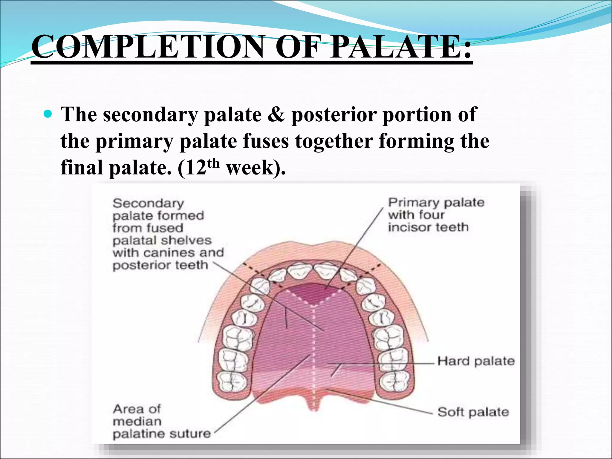 COMPLETION OF PALATE:
 The secondary palate & posterior portion of
the primary palate fuses together forming the
final palate. (12th week).
 