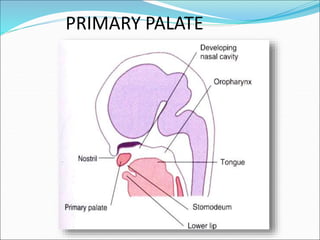DEVELOPMENT OF PALATE.ppt