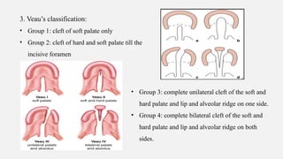 Veau Classfication DEVELOPMENT OF PALATE AND ITS APPLIED ANATOMY.pptx