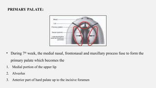 DEVELOPMENT OF PALATE AND ITS APPLIED ANATOMY.pptx