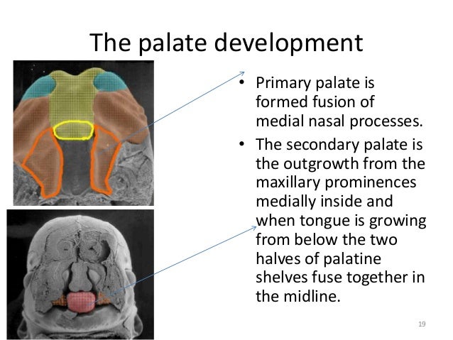 development of soft palate Abm protocol abm clinical protocol #17: guidelines for breastfeeding infants with cleft lip, cleft palate, or cleft lip and palate, revised 2013. development of soft palate Abm protocol abm clinical protocol #17: guidelines for breastfeeding infants with cleft lip, cleft palate, or cleft lip and palate, revised 2013.