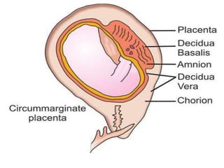 DEVELOPMENT OF PLACENTA AND FETUS.pptx