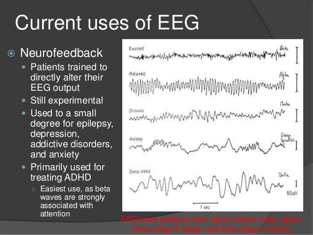 Development of portable eeg for treatment & diagnosis of disorders