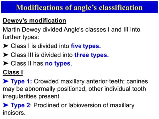 classifcation of malocclusion | PPTX