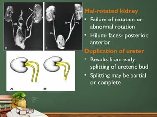 Kidney Rotation Development of renal system- PPP.pptx anatomy | PPTX