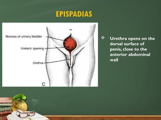 Development of renal system- PPP.pptx anatomy | PPTX