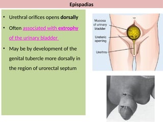 Development of Reproductive system-FB (1).pptx