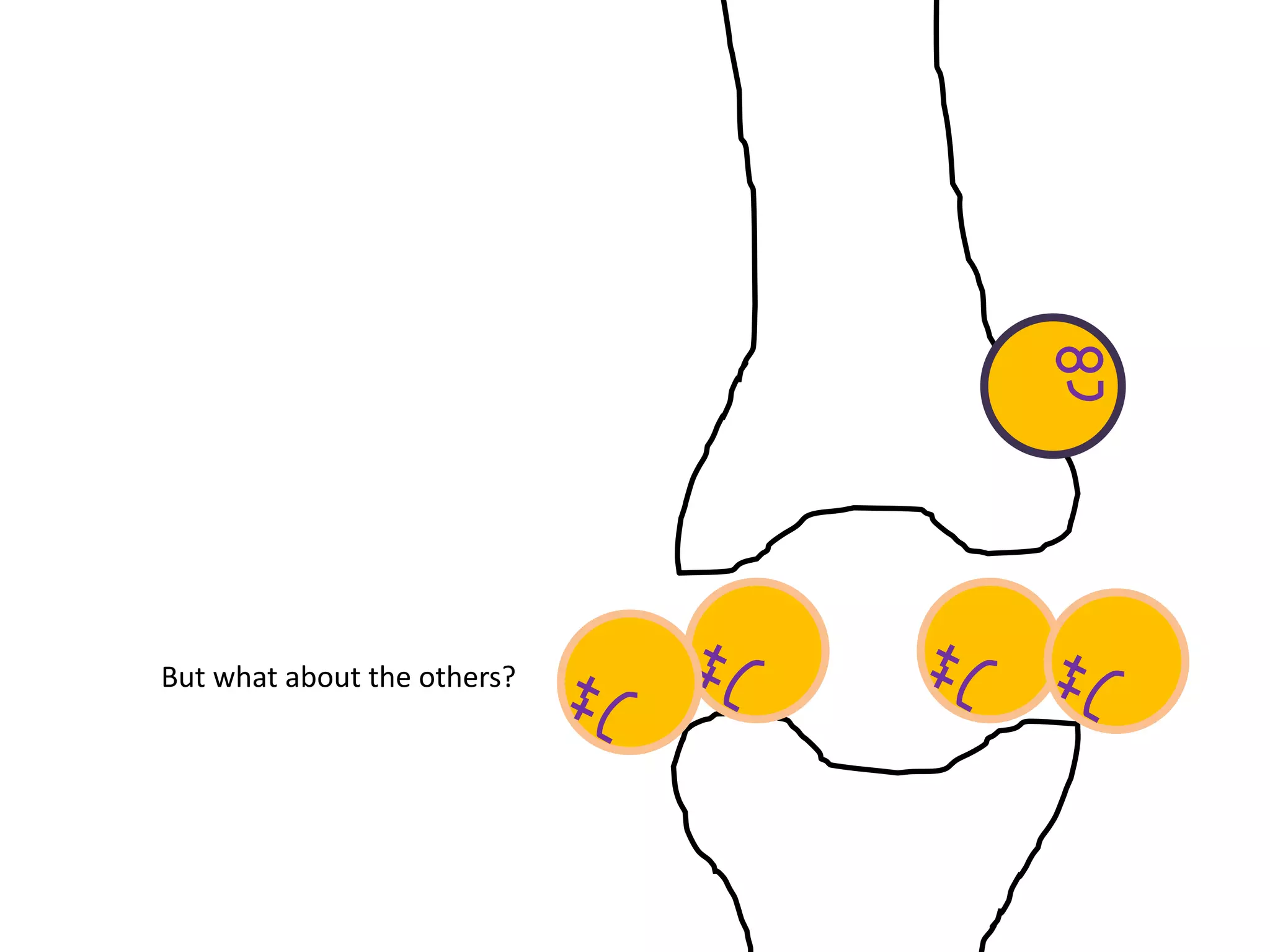 But what about the others?
 