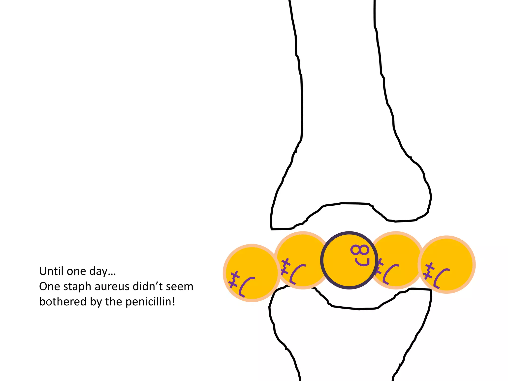 Until one day…
One staph aureus didn’t seem
bothered by the penicillin!
 